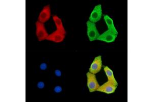 ABIN7095851 and ABIN7099913 staining Hela cells by IF/ICC. (SSX6 antibody)