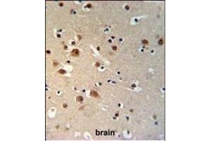 TTBK1 Antibody (N-term) (ABIN1881955 and ABIN2840093) IHC analysis in formalin fixed and paraffin embedded brain tissue followed by peroxidase conjugation of the secondary antibody and DAB staining. (TTBK1 antibody  (N-Term))