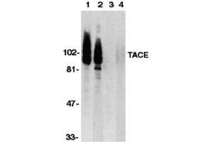 Western Blotting (WB) image for anti-ADAM Metallopeptidase Domain 17 (ADAM17) (C-Term) antibody (ABIN1030720) (ADAM17 antibody  (C-Term))
