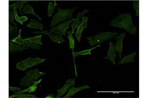 Immunofluorescence of monoclonal antibody to PIM1 on HeLa cell. (PIM1 antibody  (AA 1-313))