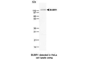 Image no. 1 for anti-Budding Uninhibited By Benzimidazoles 1 Homolog beta (Yeast) (BUB1B) antibody (ABIN363218) (BUB1B antibody)
