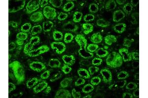 Formalin-fixed and paraffin embedded human kidney labeled with Rabbit Anti-ERK5 (Ser731+Thr733) Polyclonal Antibody, FITC Conjugated (ABIN710283) at 1:200 followed by conjugation to the secondary antibody and DAB staining (MAPK7 antibody  (pSer731, pThr733) (FITC))