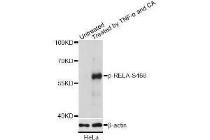 Western blot analysis of extracts of HeLa cells, using Phospho-RELA-S468 antibody (ABIN2988289) at 1/2000 dilution. (NF-kB p65 antibody  (pSer468))