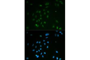 Immunofluorescence analysis of MCF-7 cells using CHEK2 antibody (ABIN5971172). (CHEK2 antibody)