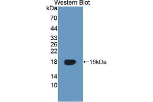 Detection of Recombinant TNFRSF19, Human using Polyclonal Antibody to Tumor Necrosis Factor Receptor Superfamily, Member 19 (TNFRSF19) (TNFRSF19 antibody  (AA 35-160))