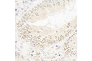 Immunohistochemistry (IHC) image for anti-DOT1-Like, Histone H3 Methyltransferase (S. Cerevisiae) (DOT1L) (AA 1000-1050) antibody (ABIN7448534)