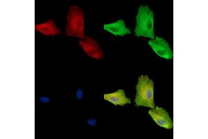 anti-Chromosome 11 Open Reading Frame 53 (C11orf53) antibody