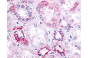 Anti-GPR91 antibody IHC of human kidney, renal tubular epithelium in cortex. (SUCNR1 antibody  (Cytoplasmic Domain))