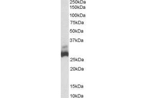 ABIN2559853 (0. (SDHB antibody  (C-Term))