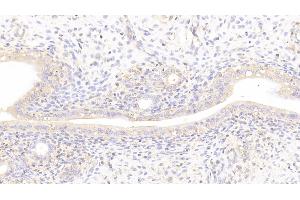 Detection of LAMb2 in Rat Uterus Tissue using Polyclonal Antibody to Laminin Beta 2 (LAMb2) (LAMB2 antibody  (AA 939-1129))