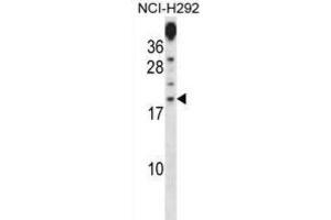 Western Blotting (WB) image for anti-Proline Rich 15 (PRR15) antibody (ABIN2998394) (Proline Rich 15 antibody)