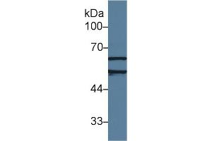 Detection of ACHE in Human Jurkat cell lysate using Polyclonal Antibody to Acetylcholinesterase (ACHE) (Acetylcholinesterase antibody  (AA 157-332))