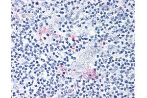 Anti-ROR Gamma antibody IHC of human thymus. (RORC antibody  (Modulating Domain))