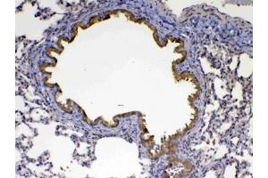 IHC testing of FFPE rat lung tissue with Factor D antibody at 1ug/ml. (Adipsin antibody  (AA 26-263))