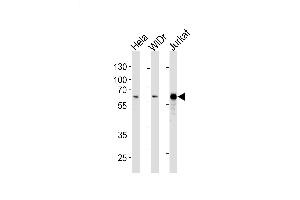Lane 1: HeLa Cell lysates, Lane 2: WiDr Cell lysates, Lane 3: Sample Tissue/Cell lysates, probed with HDAC1 (1061CT1. (HDAC1 antibody)
