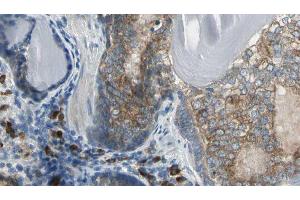 ABIN6276618 at 1/100 staining Human prostate tissue by IHC-P. (Adenylate Kinase 1 antibody  (Internal Region))