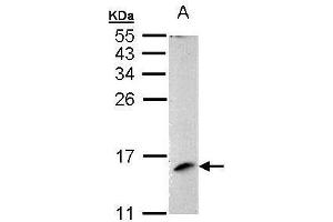 WB Image Sample (30 ug of whole cell lysate) A: 293T 15% SDS PAGE antibody diluted at 1:1000 (MAPKSP1 antibody)