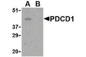 Western Blotting (WB) image for anti-Programmed Cell Death 1 (PDCD1) (Center) antibody (ABIN2479656) (PD-1 antibody  (Center))