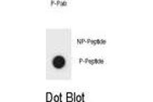 Dot blot analysis of KIT Antibody (Phospho ) Phospho-specific Pab (ABIN1881482 and ABIN2850466) on nitrocellulose membrane. (KIT antibody  (pSer959))