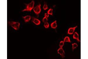 ABIN6269116 staining 293 by IF/ICC. (IGF1R antibody  (C-Term))