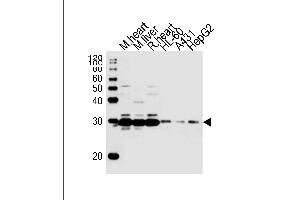 Western blot analysis of lysates from mouse heart, mouse liver, rat heart tissue, HL-60, A431, HepG2 cell line (from left to right), using (DANRE) sdhb Antibody Azb18722a. (SDHB antibody  (AA 147-182))