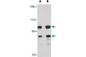 Western blot analysis of DLGAP1 in rat brain tissue lysate with DLGAP1 polyclonal antibody  at (A) 0. (DLGAP1 antibody  (Internal Region))
