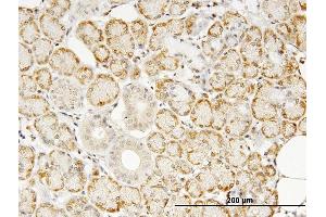 Immunoperoxidase of monoclonal antibody to TNF on formalin-fixed paraffin-embedded human salivary gland.