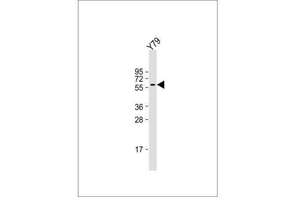 SLC5A12 antibody  (C-Term)