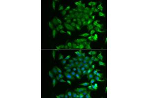 Immunofluorescence analysis of MCF-7 cells using RBP2 antibody (ABIN5974059). (RBP2 antibody)