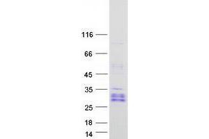 Western Blotting (WB) image for YY1 Associated Factor 2 (YAF2) protein (Myc-DYKDDDDK Tag) (ABIN2735708)