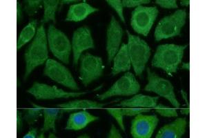 Immunofluorescence analysis of L929 cells using SARDH Polyclonal Antibody at dilution of 1:100 (40x lens). (SARDH antibody)