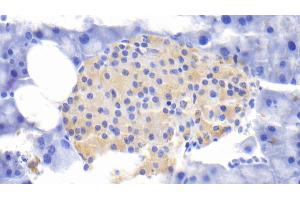 Detection of IL1RA in Mouse Pancreas Tissue using Polyclonal Antibody to Interleukin 1 Receptor Antagonist (IL1RA) (IL1RN antibody  (AA 27-178))