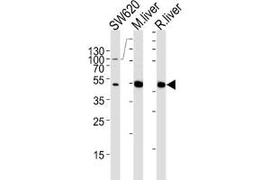 Western Blotting (WB) image for anti-Ornithine Carbamoyltransferase (OTC) antibody (ABIN3002885) (OTC antibody)