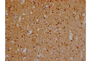 IHC image of ABIN7127835 diluted at 1:100 and staining in paraffin-embedded human brain tissue performed on a Leica BondTM system. (Recombinant MAPT antibody)