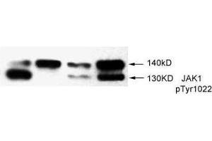 Image no. 1 for anti-Janus Kinase 1 (JAK1) (pTyr1022) antibody (ABIN273478) (JAK1 antibody  (pTyr1022))
