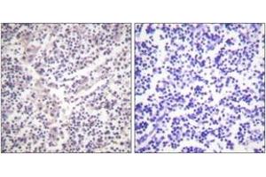 Immunohistochemistry analysis of paraffin-embedded human lymph node, using Caspase 3 (Phospho-Ser150) Antibody.