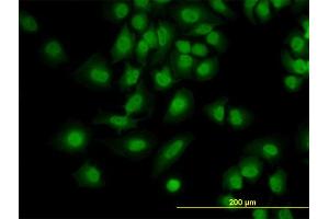 Immunofluorescence of monoclonal antibody to PDCD6 on HeLa cell. (PDCD6 antibody  (AA 92-191))