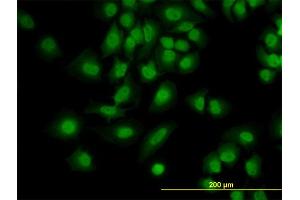 Immunofluorescence of monoclonal antibody to PDCD6 on HeLa cell.