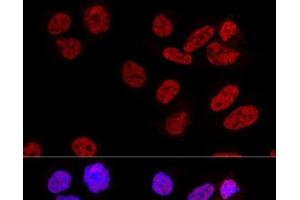 Confocal immunofluorescence analysis of U2OS cells using CPSF6 Polyclonal Antibody at dilution of 1:100. (CPSF6 antibody)