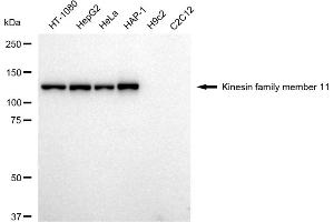 Western blotting analysis using Kinesin family member 11 antibody (ABIN7799200).