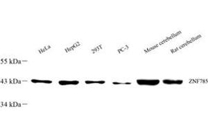 Western blot analysis of ZNF785 (ABIN7076274) at dilution of 1: 500 (ZNF785 antibody)