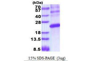 Figure annotation denotes ug of protein loaded and % gel used. (ESM1 Protein)