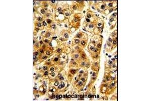 Immunohistochemistry (Paraffin-embedded Sections) (IHC (p)) image for anti-Nuclear Factor of kappa Light Polypeptide Gene Enhancer in B-Cells Inhibitor, alpha (NFKBIA) (AA 12-41) antibody (ABIN652417)