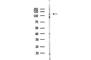 anti-DEAH (Asp-Glu-Ala-His) Box Polypeptide 36 (DHX36) (C-Term) antibody