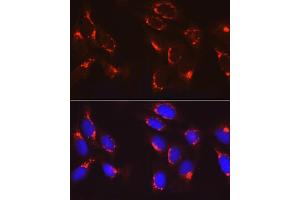 Immunofluorescence analysis of U2OS cells using COPB2 Rabbit pAb (ABIN6129253, ABIN6138871, ABIN6138872 and ABIN6222818) at dilution of 1:100 (40x lens). (COPB2 antibody  (AA 657-906))