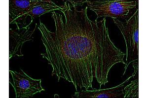 Immunocytochemistry (ICC) image for anti-FYN Oncogene Related To SRC, FGR, YES (FYN) (AA 7-176) antibody (ABIN94311)