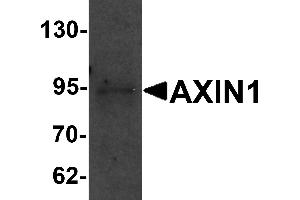 Western Blotting (WB) image for anti-Axin 1 (AXIN1) (C-Term) antibody (ABIN1030273)