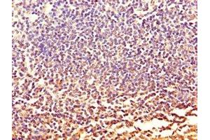 Immunohistochemistry of paraffin-embedded human tonsil tissue using ABIN7146099 at dilution of 1:100 (CXCR2 antibody  (AA 1-40))