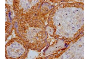 Immunohistochemistry (IHC) image for anti-Epidermal Growth Factor Receptor (EGFR) antibody (ABIN7127467)