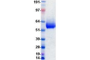 Western Blotting (WB) image for Fibroblast Growth Factor Receptor 1 (FGFR1) protein (DYKDDDDK-His Tag) (ABIN2721114)